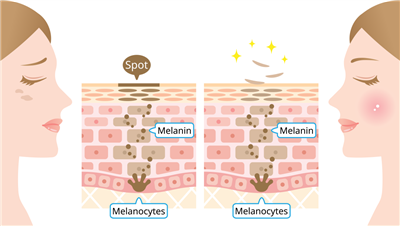 probiootiline nahahooldus